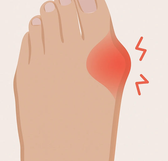 Les conséquences des chaussures trop serrées : déformations du pied