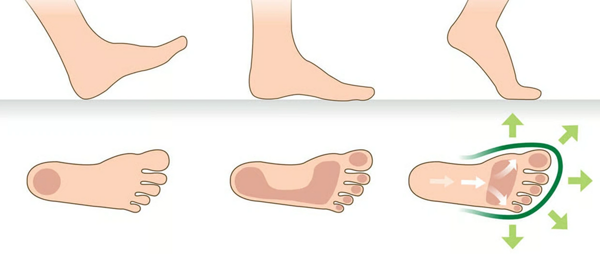 Relief for every foot