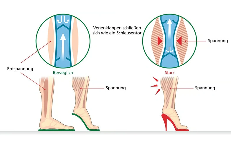 Diagram shows the impact of flat and high heels on leg vein function.