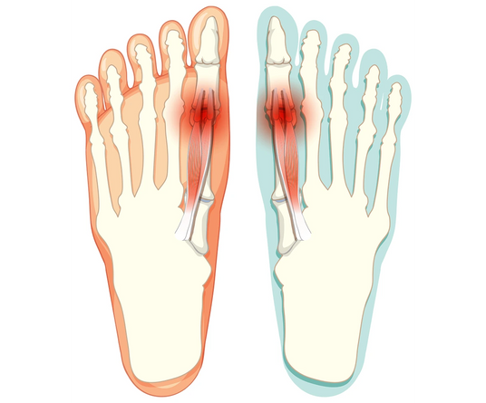 We know how much the wrong shoes can strain you.